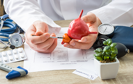 A jóindulatú prosztata-megnagyobbodás – Ne várjon a tünetek súlyosbodására!